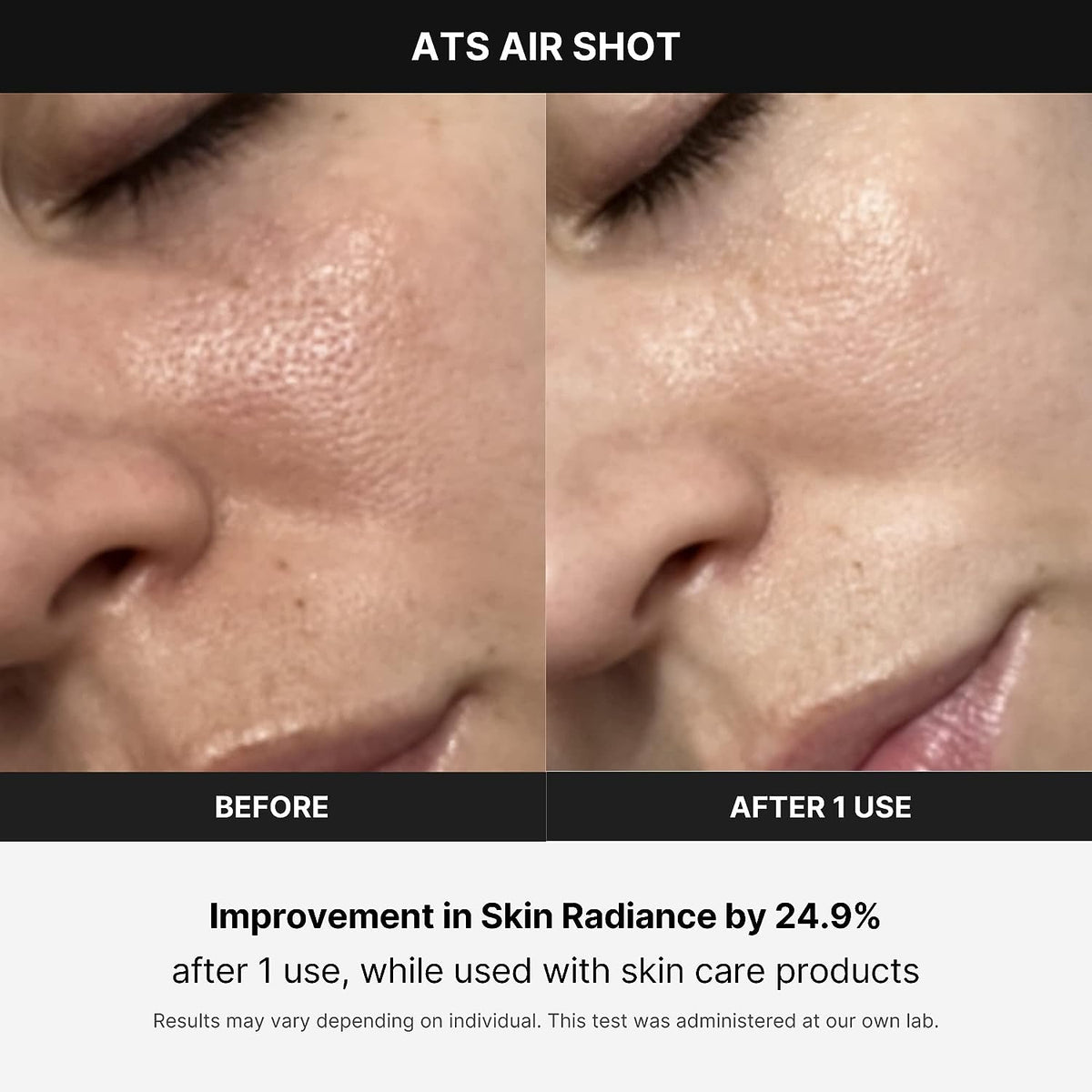 Age-R ATS Air Shot - Microneedling Pore Tightening Skin Care Device for Enhanced Absorption, Pore Refinement, and Smoother Skin Texture - Exfoliation, Skin Rejuvenation - Korean Skin Care