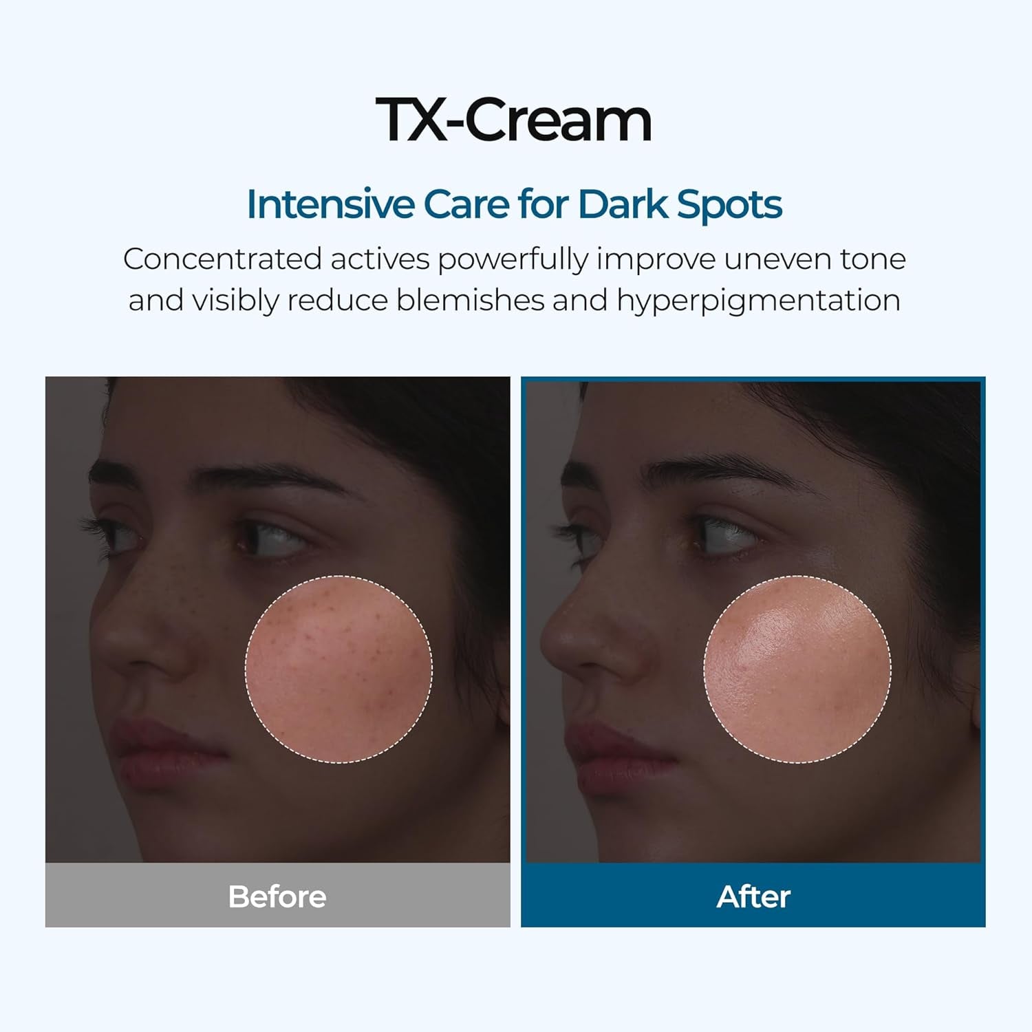 GlowFade™ TX Tranexamic Acid Cream – Korean Anti-Pigmentation & Freckle Corrector for Clear, Even-Toned Skin (50ml)